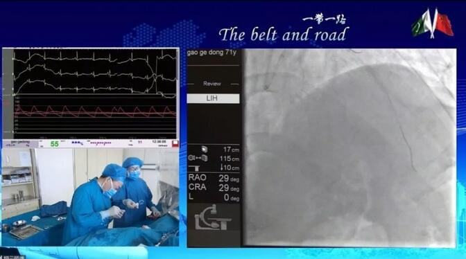 中國(guó)聯(lián)通完成5G直播心臟介入手術(shù)